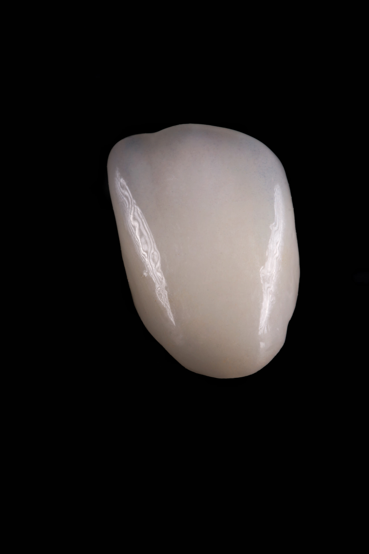 Facetas em e.max — detalhe de translucidez