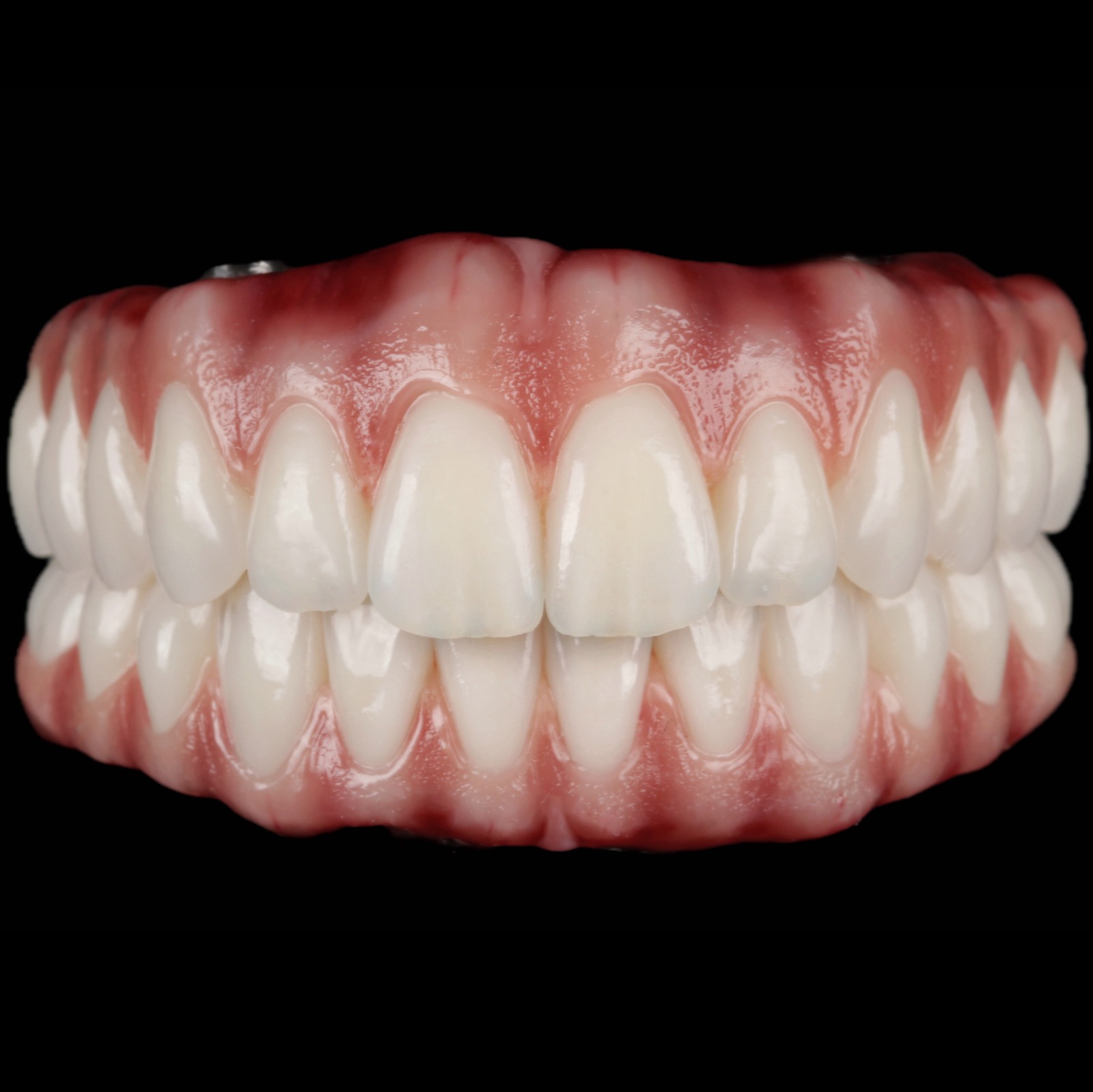 Detalhe aproximado da gengiva caracterizada em protocolo acrílico