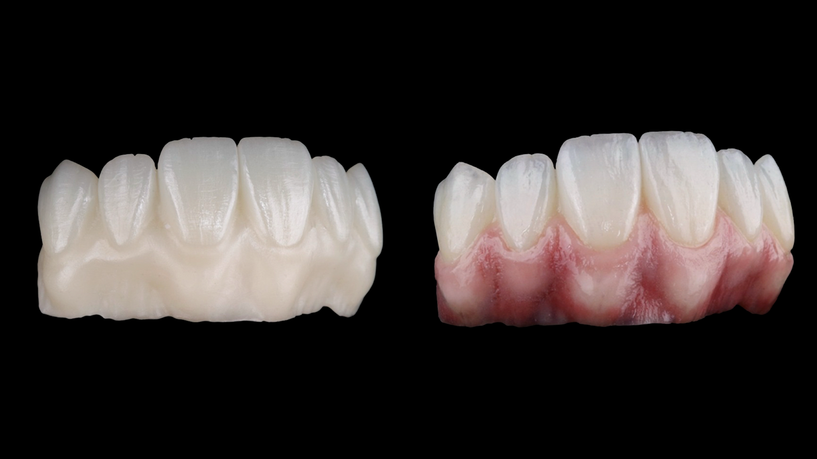 Comparativo de estrutura cerâmica antes e depois da caracterização de gengiva