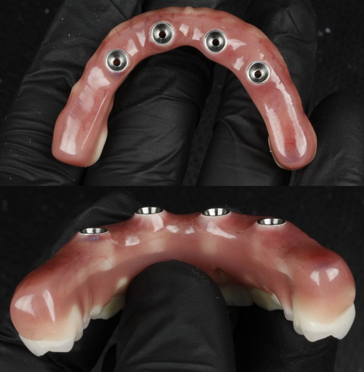 Detalhe aproximado da gengiva caracterizada